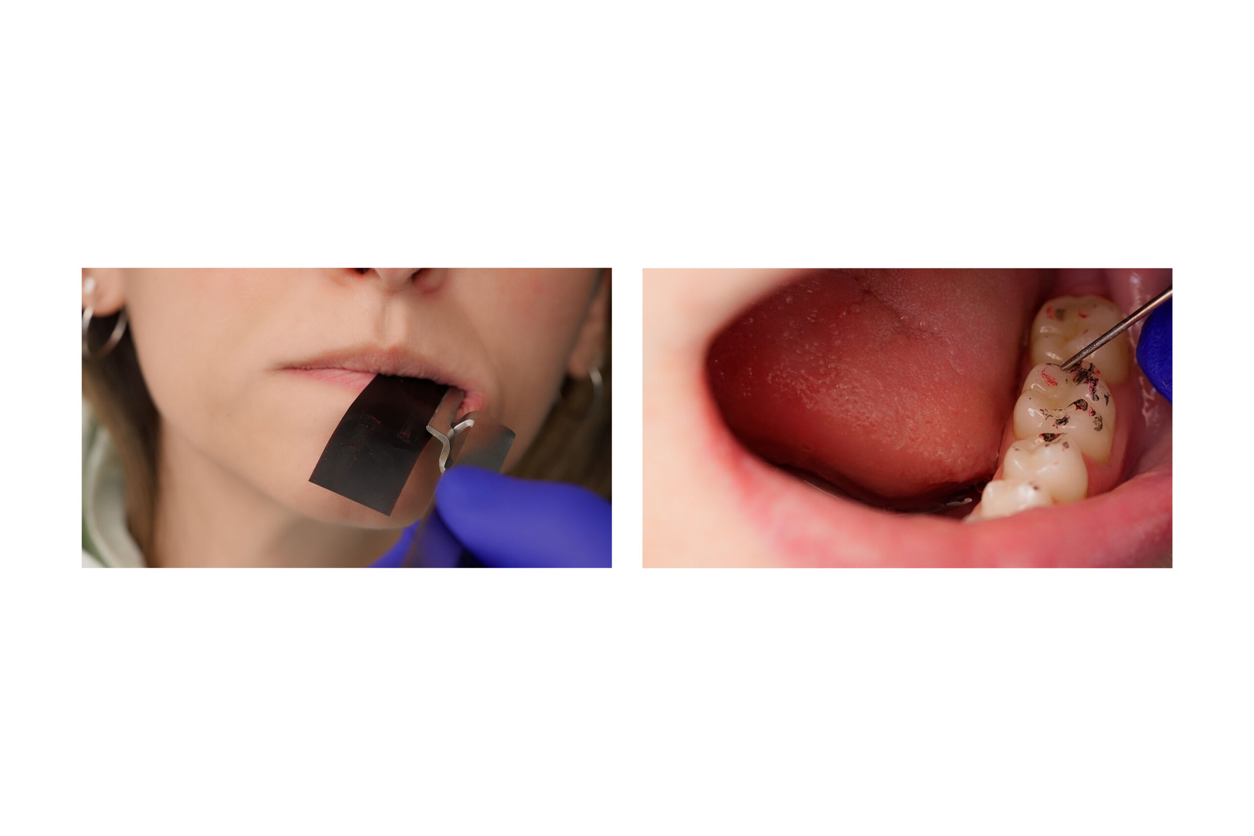 AccuFilm® Papiers à articuler – Image 2