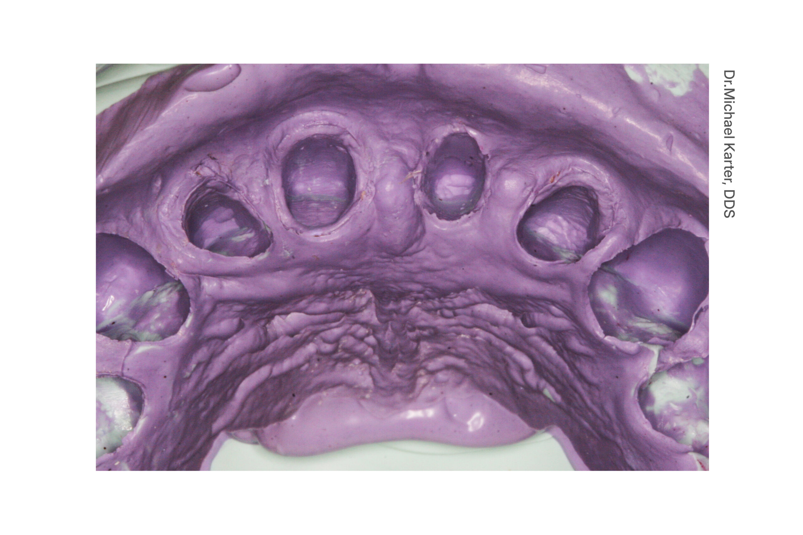 Cinch Clinical Image