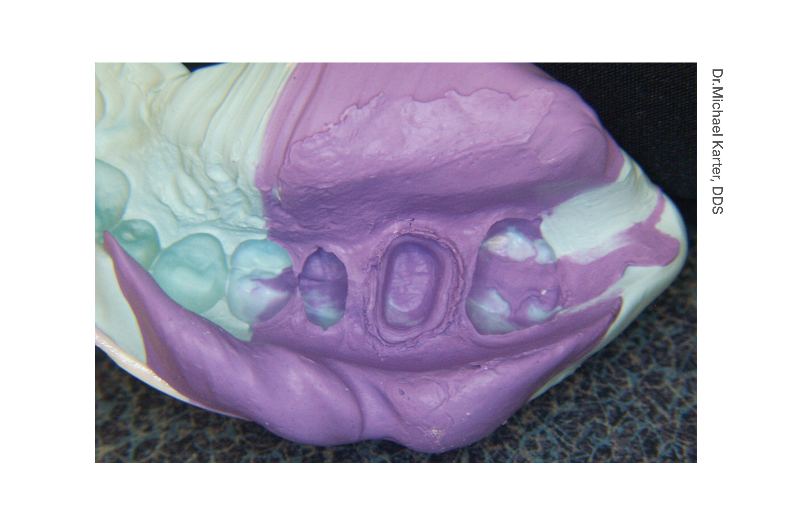 Cinch Clinical Image