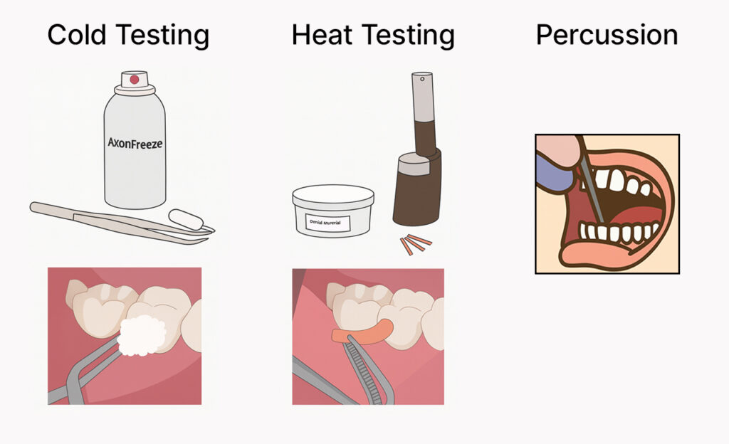 Conventional Pulp Tests